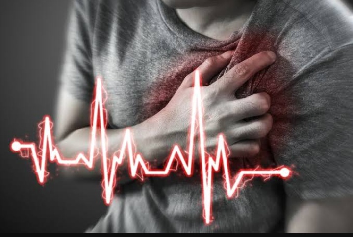 Serangan Jantung Tiba-Tiba Kerap Tidak Diketahui Penderita