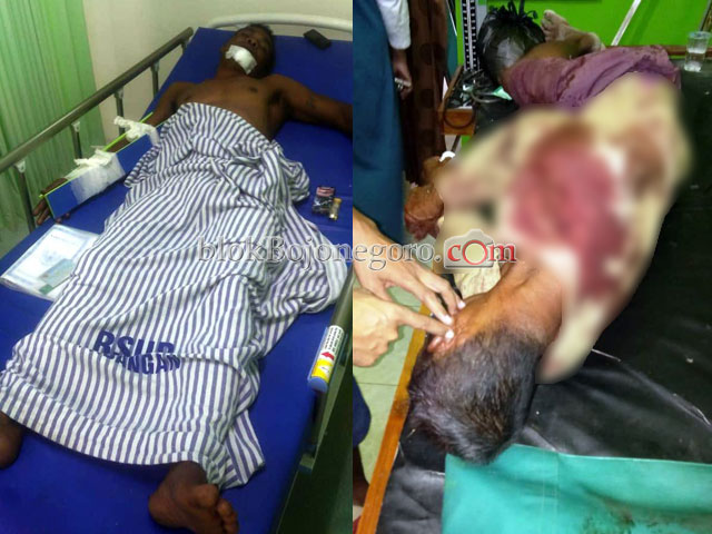 Diduga Salah Paham, Dua Warga Tambakrejo Saling Bacok