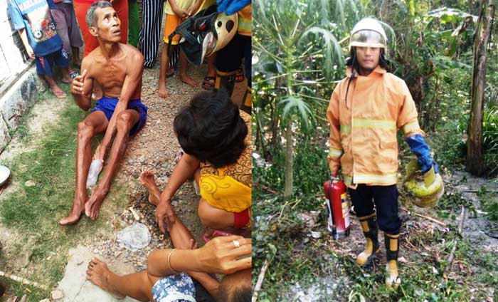 Tabung Gas Bocor saat Masak, 2 Warga Luka Bakar