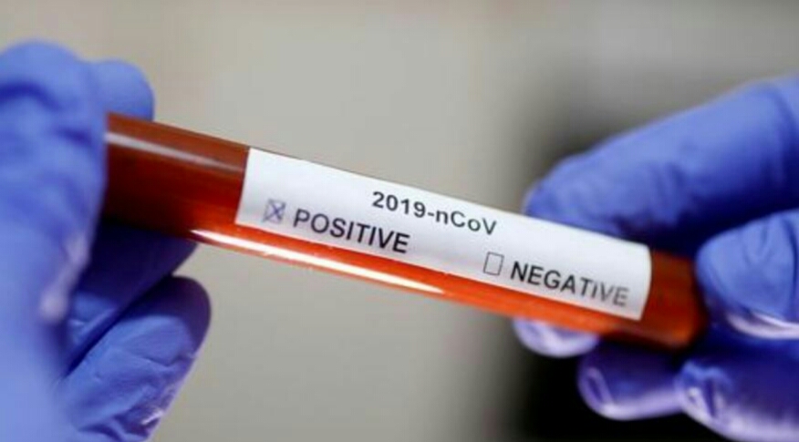 70 Swab Pedagang Pasar Keluar, Total 7 Positif Covid-19