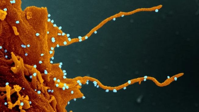Terus Mutasi, Sebenarnya Ada Berapa Virus Corona Penyebab Sakit Covid-19?