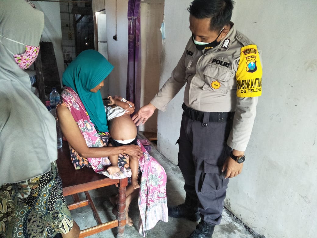 Sejak Umur 3 Bulan, Balita Hafiz Derita Tumor Ginjal