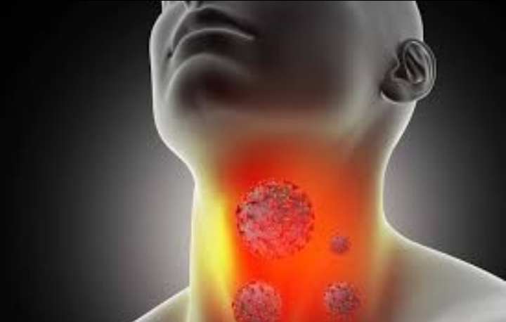 Beda Sakit Tenggorokan Biasa Dan Omicron