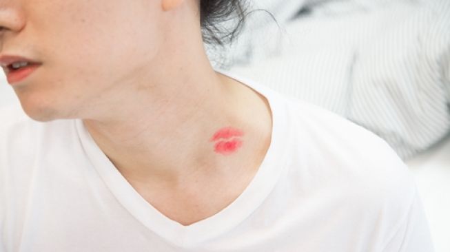 Malu Bekas Cupang Tak Cepat Hilang? Coba Pakai 3 Cara Ini!