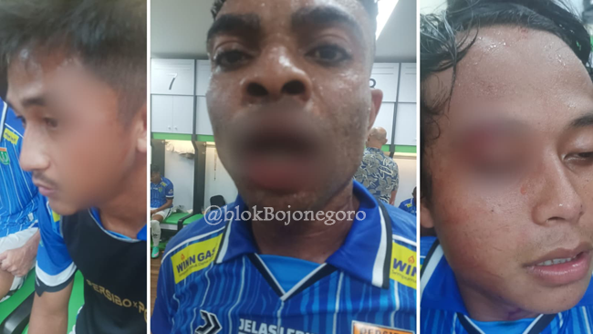 Manajemen Persibo Lakukan Pemulihan Trauma ke Pemain