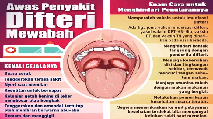 Dinkes: Vaksin Bisa Cegah Difteri